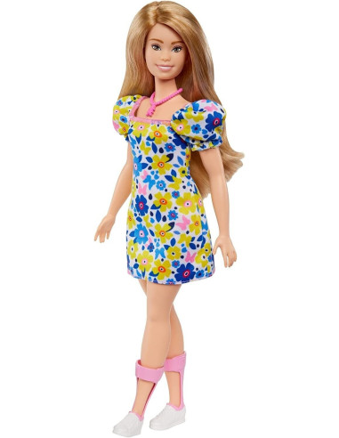 Barbie Sindrome di Down